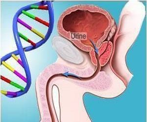 Ailevi – Genetik Geçişli Prostat Kanserleri