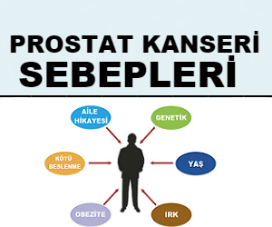 Prostat Kanseri Sebepleri Nelerdir?