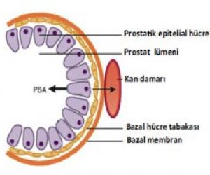 PSA Nedir, Değerleri ve Özellikleri Nelerdir?