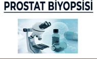 PROSTAT BİYOPSİSİ