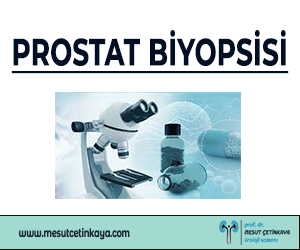 PROSTAT BİYOPSİSİ