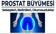 PROSTAT BÜYÜMESİNİN SEBEPLERİ, BELİRTİLERİ VE YARATABİLECEĞİ OLUMSUZLUKLAR